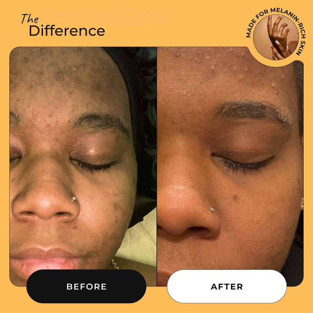 Brightening Lemon Turmeric & Kojic Acid Soap