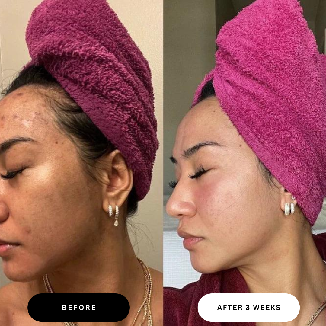 Brightening Lemon Turmeric & Kojic Acid Soap