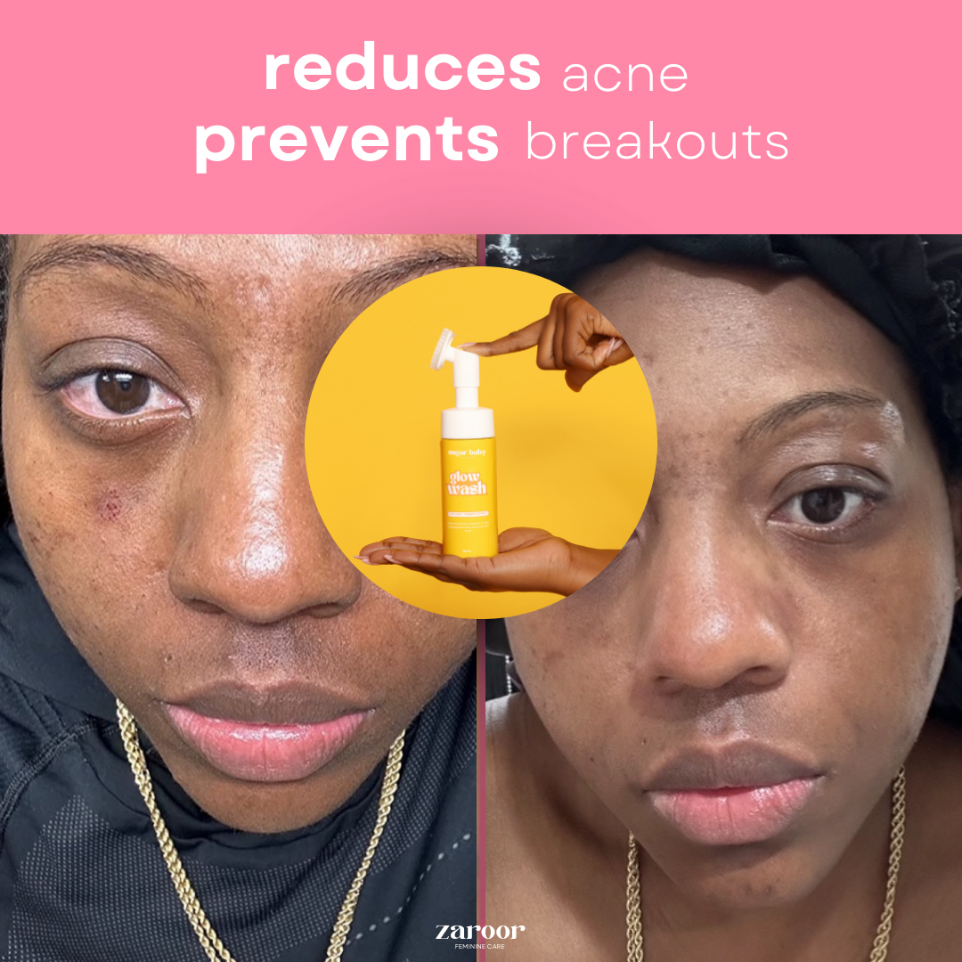Turmeric & Kojic Acid Glow Wash